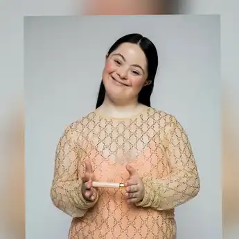 Gadis Down Syndrome Jadi Model Merek Gucci dan Vogue Italia 
