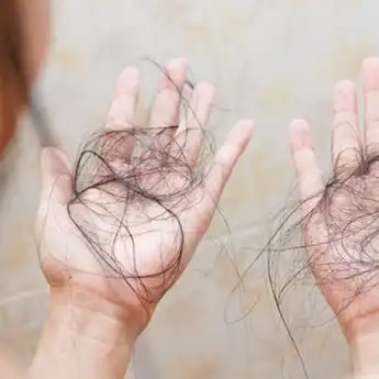 10 Arti Mimpi Rambut Rontok, Benarkah Menunjukkan Pertanda Buruk?